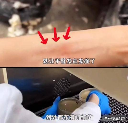 比想象中的更加恶心难怪女性会得妇科病AG真人旗舰厅315晚会大爆雷出现了(图2)