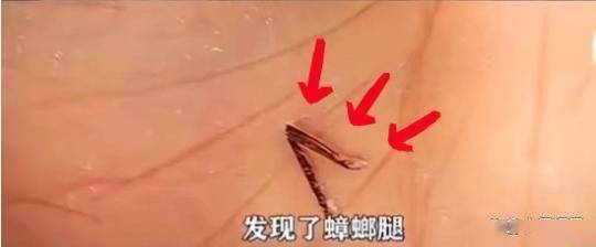 比想象中的更加恶心难怪女性会得妇科病AG真人旗舰厅315晚会大爆雷出现了(图11)